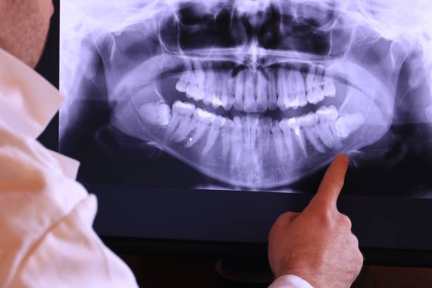 Best Broken or Chipped Tooth Repair in Fetters Hot Springs Agua Liente, CA